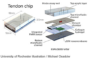 Rochester-fea-tendon-chip-300-t.jpg