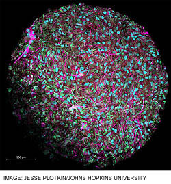 Johns-Hopkins-biotietokone-ihmisen-aivosoluista-250-t.jpg